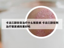卡泊三醇软膏治疗什么银屑病 卡泊三醇搽剂治疗银屑病效果好吗
