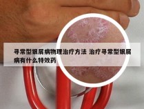 寻常型银屑病物理治疗方法 治疗寻常型银屑病有什么特效药