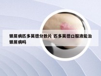 银屑病匹多莫德分散片 匹多莫德口服液能治银屑病吗