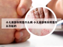 小儿面部白斑是什么病 小儿面部有白斑是什么引起的