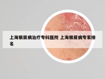 上海银屑病治疗专科医院 上海银屑病专家排名