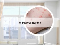 牛皮癣吃海参治好了