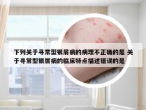 下列关于寻常型银屑病的病理不正确的是 关于寻常型银屑病的临床特点描述错误的是