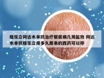 格乐立阿达木单抗治疗银屑病几周起效 阿达木单抗格乐立用多久原来的西药可以停