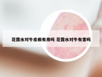 花露水对牛皮癣有用吗 花露水对牛有害吗