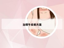 治理牛皮癣方案