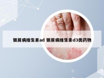 银屑病维生素ad 银屑病维生素d3类药物