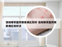 洛阳哪家医院银屑病比较好 洛阳哪家医院银屑病比较好点