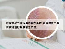 石家庄省二院治牛皮癣怎么样 石家庄省二院皮肤科治疗皮肤病怎么样
