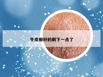 牛皮癣好的剩下一点了