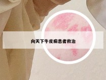 向天下牛皮癣患者救治