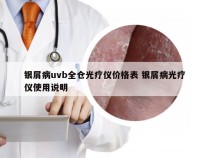 银屑病uvb全仓光疗仪价格表 银屑病光疗仪使用说明
