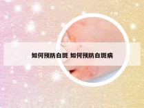 如何预防白斑 如何预防白斑病