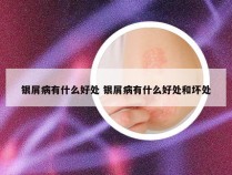银屑病有什么好处 银屑病有什么好处和坏处