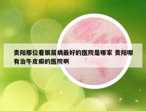 贵阳那位看银屑病最好的医院是哪家 贵阳哪有治牛皮癣的医院啊