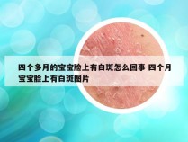 四个多月的宝宝脸上有白斑怎么回事 四个月宝宝脸上有白斑图片