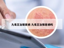 九毒王治银屑病 九毒王治银屑病吗