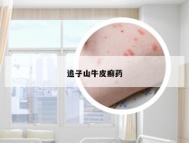 追子山牛皮癣药