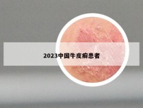 2023中国牛皮癣患者