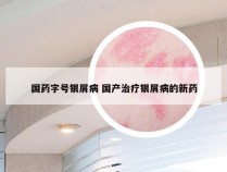 国药字号银屑病 国产治疗银屑病的新药