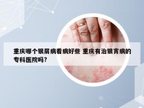 重庆哪个银屑病看病好些 重庆有治银宵病的专科医院吗?
