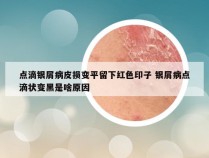 点滴银屑病皮损变平留下红色印子 银屑病点滴状变黑是啥原因