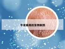 牛皮癣用的生物制剂