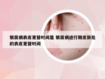 银屑病表皮更替时间是 银屑病进行期皮损处的表皮更替时间