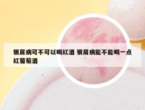 银屑病可不可以喝红酒 银屑病能不能喝一点红葡萄酒