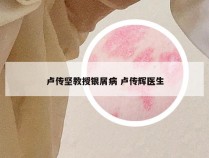 卢传坚教授银屑病 卢传辉医生