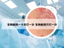 生物制剂一个月打一针 生物制剂只打一针