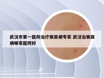武汉市第一医院治疗银屑病专家 武汉治银屑病哪家医院好