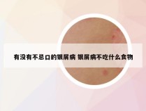 有没有不忌口的银屑病 银屑病不吃什么食物