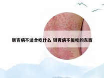 银宵病不适合吃什么 银霄病不能吃的东西