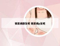 银屑病群友吧 银屑病p友吧