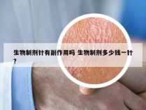 生物制剂针有副作用吗 生物制剂多少钱一针?