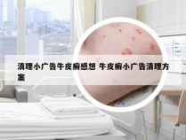 清理小广告牛皮癣感想 牛皮癣小广告清理方案