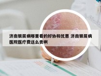 济南银屑病哪里看的好协和优惠 济南银屑病医院医疗费这么贵啊
