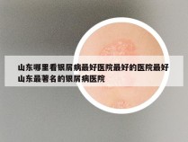 山东哪里看银屑病最好医院最好的医院最好 山东最著名的银屑病医院