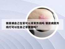 银屑病自己在家可以用紫外线吗 银屑病紫外线灯可以在自己家里做吗?