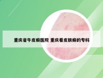 重庆省牛皮癣医院 重庆看皮肤癣的专科