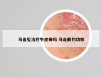 马齿见治疗牛皮癣吗 马齿藓的功效