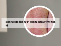 华医皮肤病费用多少 华医皮肤病研究院怎么样