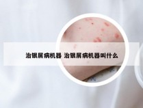 治银屑病机器 治银屑病机器叫什么