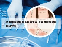 长春哪家银屑病治疗最专业 长春市银康银屑病研究院