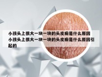 小孩头上很大一块一块的头皮癣是什么原因 小孩头上很大一块一块的头皮癣是什么原因引起的