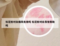 松花粉对白癜风有用吗 松花粉对白发有帮助吗
