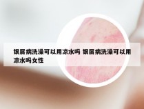 银屑病洗澡可以用凉水吗 银屑病洗澡可以用凉水吗女性