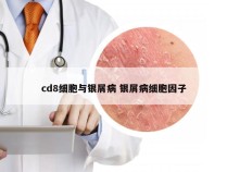 cd8细胞与银屑病 银屑病细胞因子