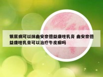 银屑病可以抹曲安奈德益康唑乳膏 曲安奈德益康唑乳膏可以治疗牛皮癣吗